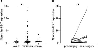 E47 as a novel glucocorticoid-dependent gene mediating lipid metabolism in patients with endogenous glucocorticoid excess